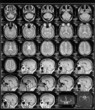 head magnetic resonance image