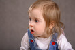 Sweet Handicapped Baby Girl