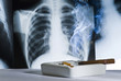 Radiografie