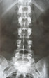 X-ray