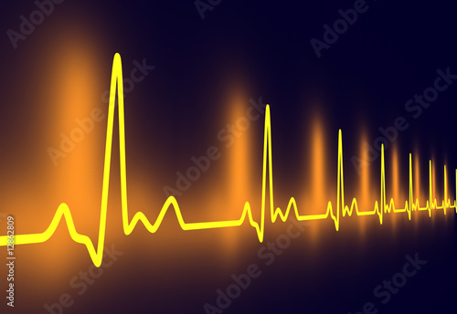 Illustration: EKG Puls EKG Puls
