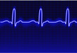 ECG trace