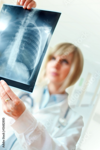 Foto: Female doctor examing an x-ray Female doctor examing an x-ray