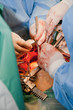 Operation on open heart
