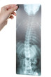 x-ray
