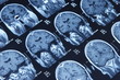 raggi x