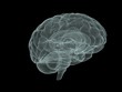 x-ray brain