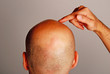 Kein Haar