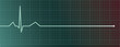Heart pulse monitor with flatline