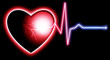EKG