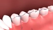 Cleaning Teeth