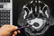 Computertomographie