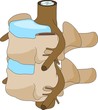vertebra disc anatomy