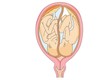 Unborn Twin Childs