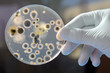 Hand Holds Petri Dish with Bacteria Culture Hand Holds Petri Dish with Bacteria Culture