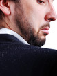 Dandruff issue on man's sholder