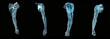 Anatomy an arm x-ray Anatomy an arm x-ray