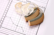 medical chart and hearing aid medical chart and hearing aid