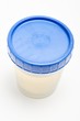 Urine sample in plastic pot