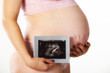 Foto: Babybauch und Ultraschallbild Babybauch und Ultraschallbild