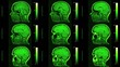 Video: Real world RMI human brain scan Real world RMI human brain scan