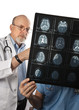 Two Doctors Viewing MRI Scans