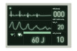 herzmonitor negativ