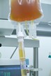 Foto: plasma transfusion 1 plasma transfusion 1
