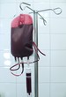 Foto: blood transfusion 1 blood transfusion 1