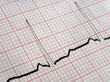 électrocardiogramme