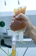 Foto: plasma transfusion with hand plasma transfusion with hand