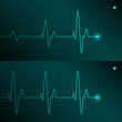 ECG tracing. Vector illustration. ECG tracing. Vector illustration.