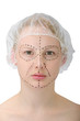 Photo: woman´s face before plastic surgery, face lift woman´s face before plastic surgery, face lift