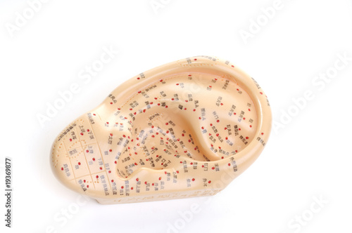 Photo: acupuncture acupuncture