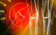 Human leg bone