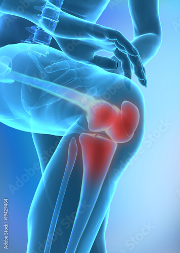 Illustration: Human knee injury concept Human knee injury concept