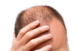 Stressed man