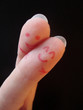 Finger