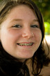 braces on her teeth