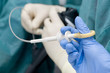 Endoscopic biopsy Endoscopic biopsy