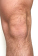 knee