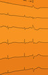 Elektrokardiogramm