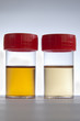 Urine Test