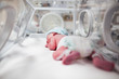 Photo: Newborn baby boy covered in vertix inside incubator Newborn baby boy covered in vertix inside incubator