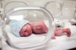Photo: Newborn baby covered in vertix in incubator Newborn baby covered in vertix in incubator