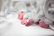Photo: Newborn baby boy covered in vertix inside incubator Newborn baby boy covered in vertix inside incubator