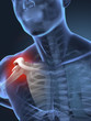 Painful human arm