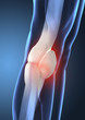 Painful human knee concept Painful human knee concept