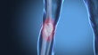 Painful  human knee concept