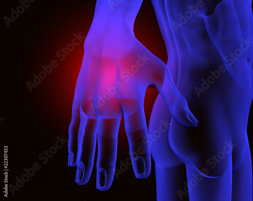 Illustration: dolor en la mano dolor en la mano